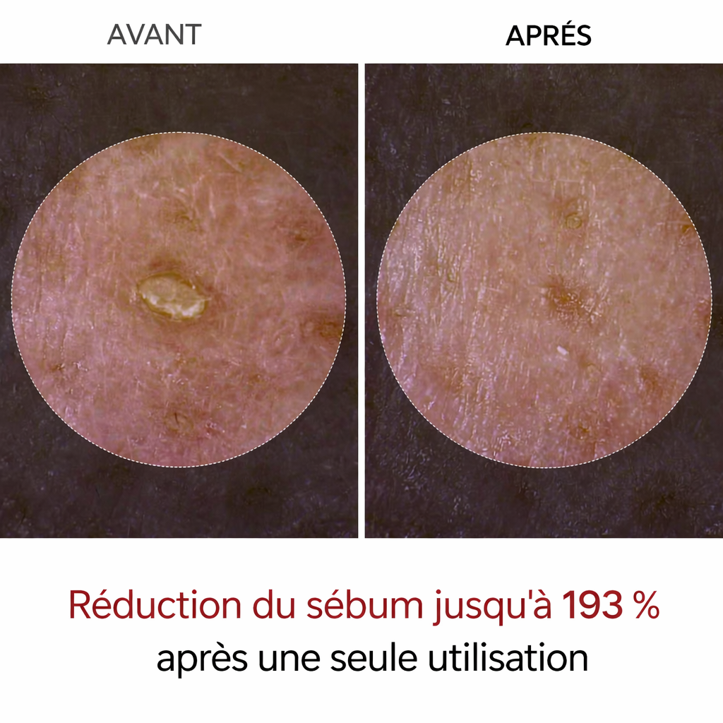 Korean peel shot exfoliant