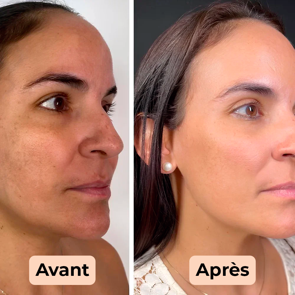 Korean peel shot exfoliant